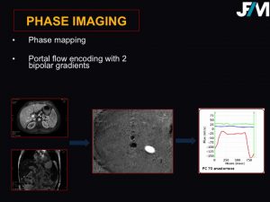 L ARRIVE Liver Transplantation JFIM Mumbai 2016