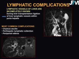 L ARRIVE Liver Transplantation JFIM Mumbai 2016